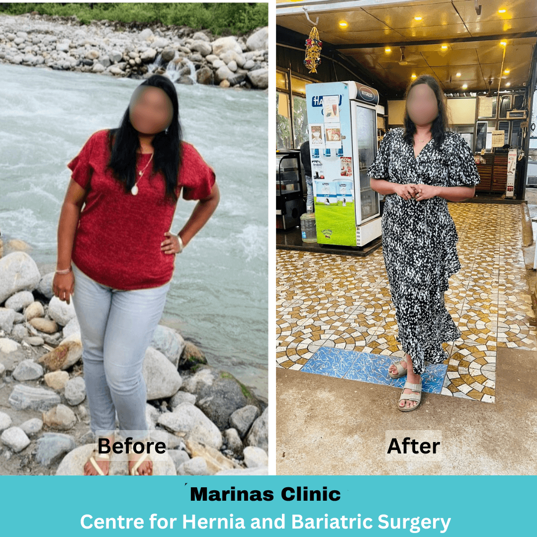 Patient Result 4