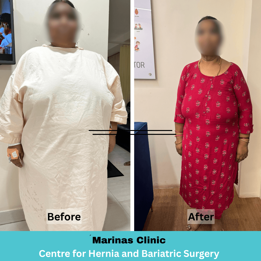Patient Result 5