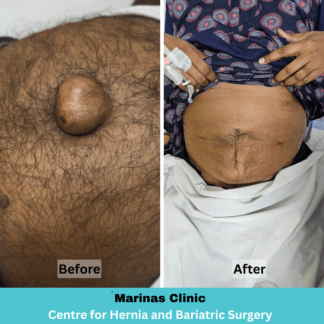 Patient Result 3