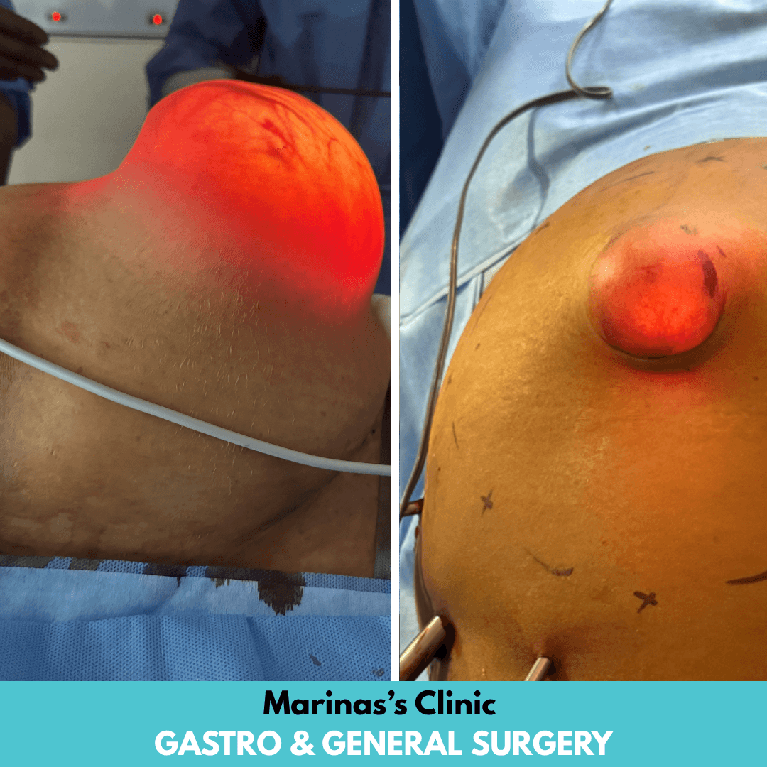 Patient Result 2