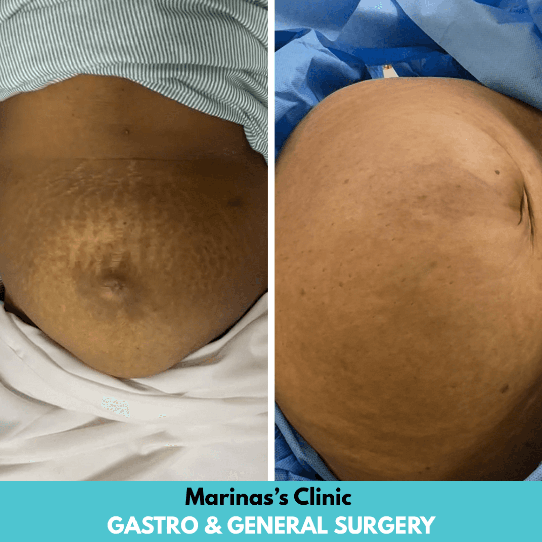Patient Result 1